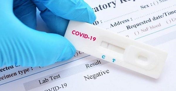 PCR Testi nedir, sonuçları ne zaman çıkar? Korona testi sonucu ne zaman çıkar? Ankara’da Covid-19 test sonucu kaç günde ve ne zaman çıkar? 1